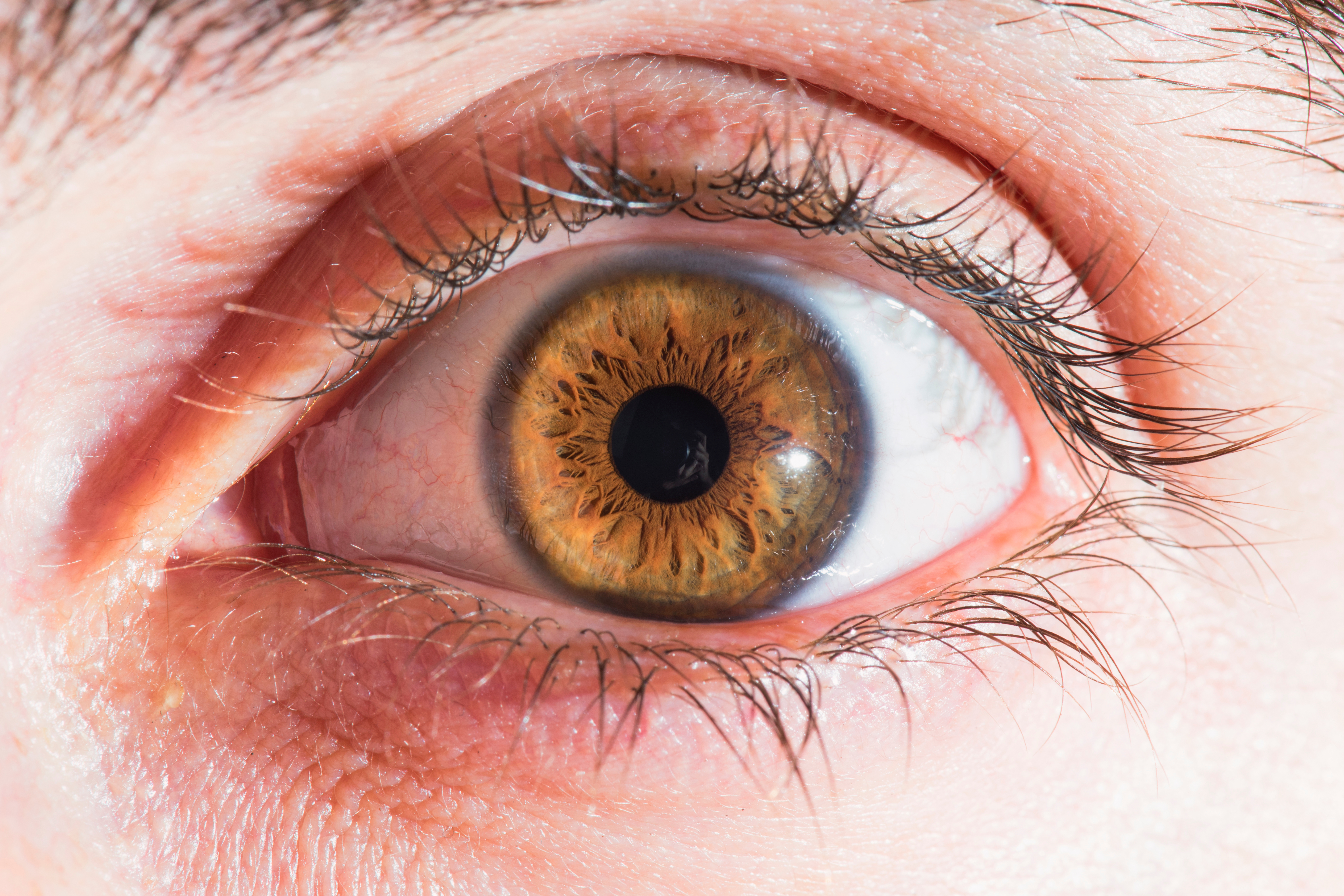 Image for Arabic - Your guide to diabetic retinopathy