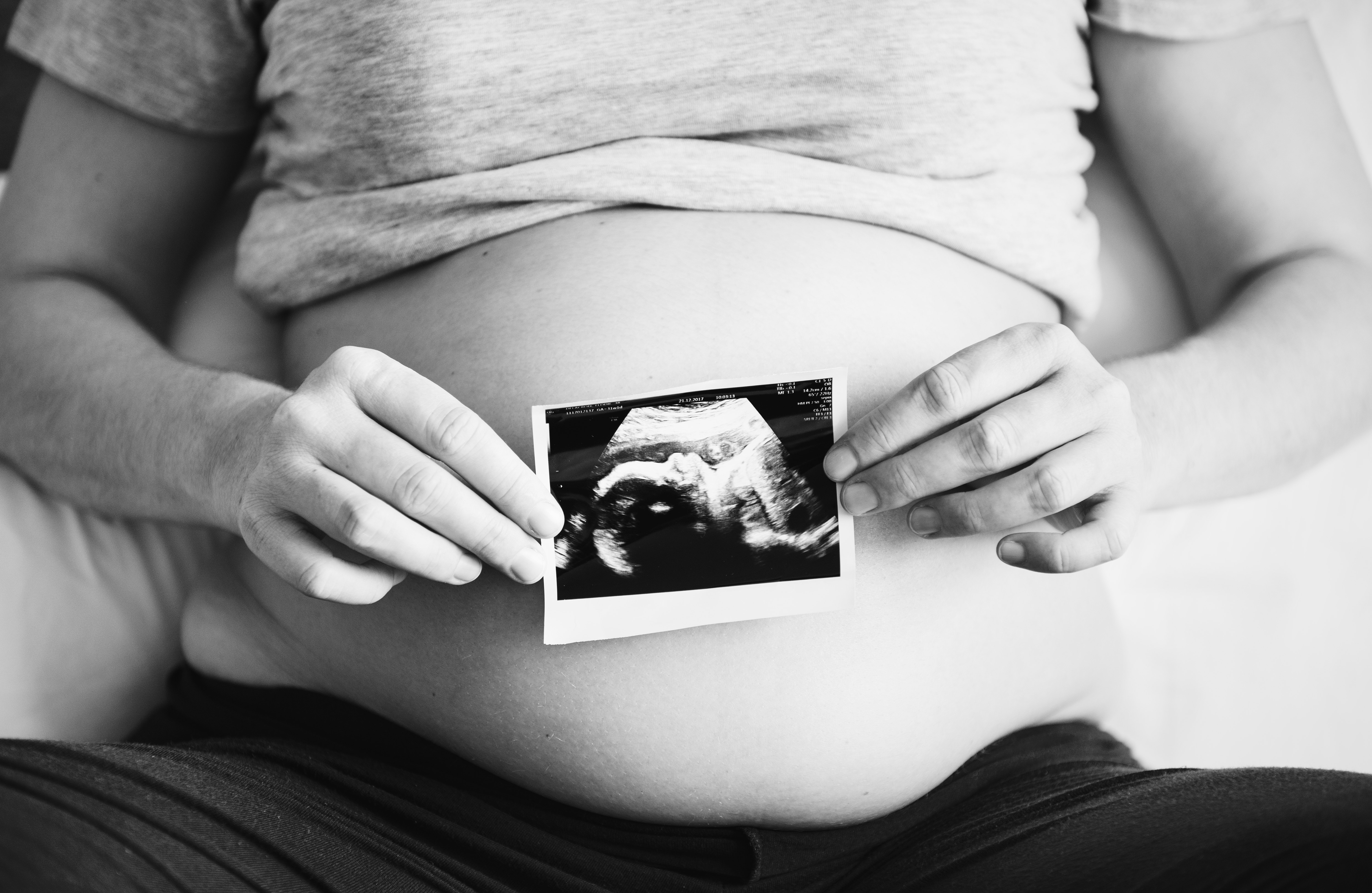 Image for Gestational Diabetes